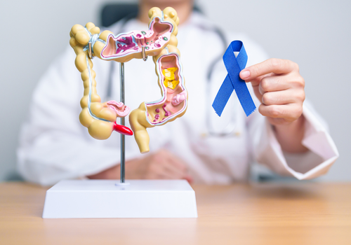 doctor with 3D colon diagram